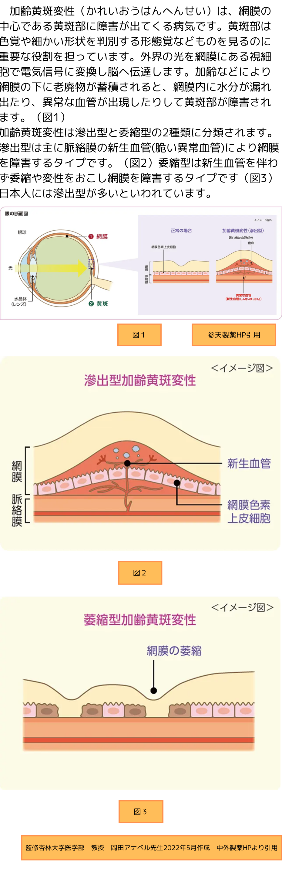 加齢黄斑変性の治療 | 沖田眼科公式ホームページ